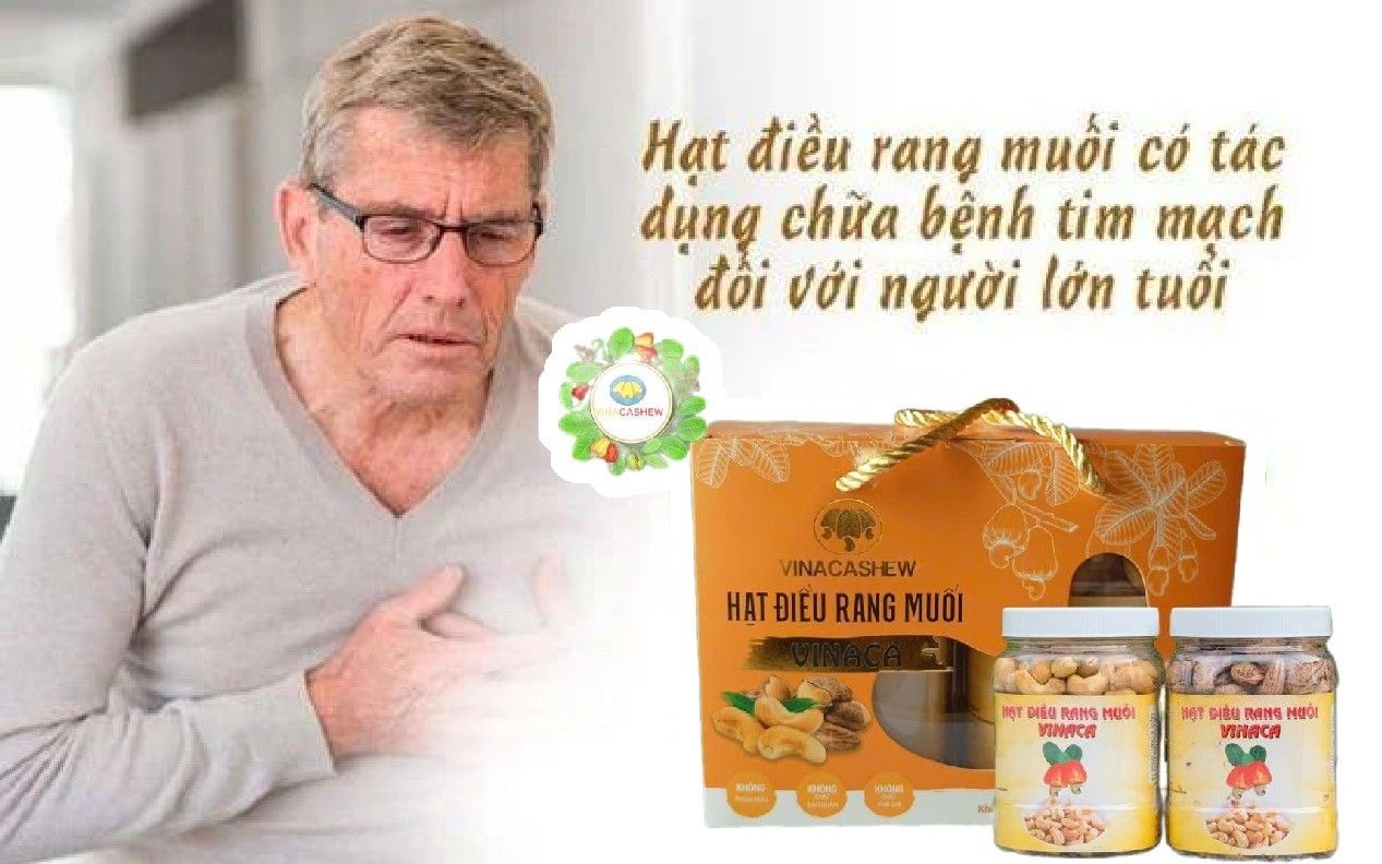 10 Lý Do Bạn Nên Ăn Hạt Điều Mỗi Ngày photo 2024 12 07 13 30 17